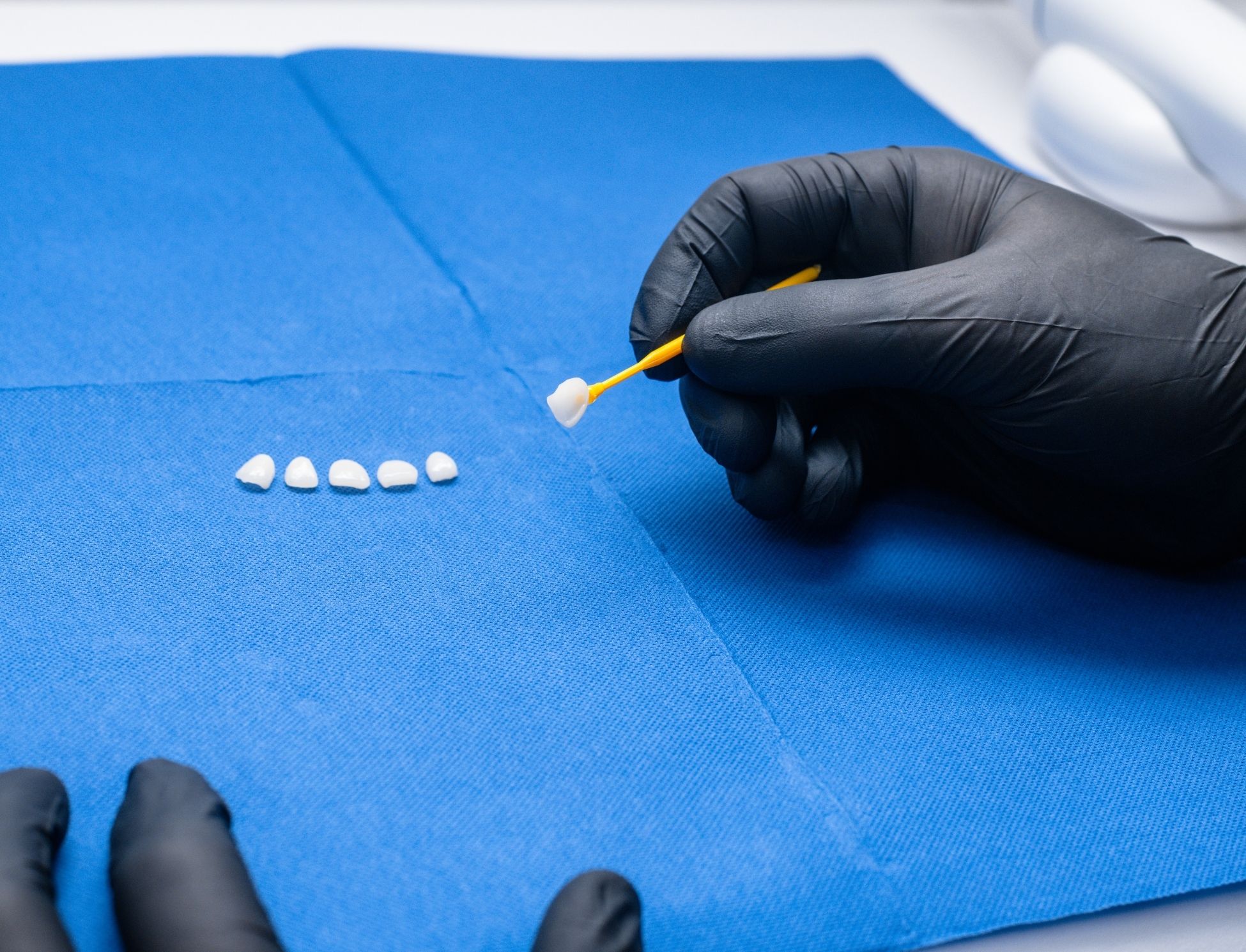 faccette dott enrico zara